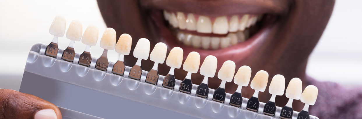 What the color of your teeth says about you - Delta Dental